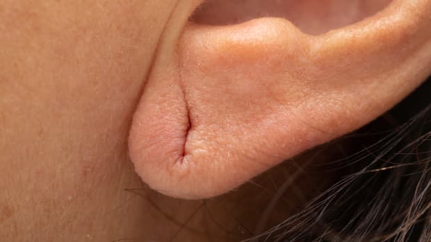 woman with a long earlobe