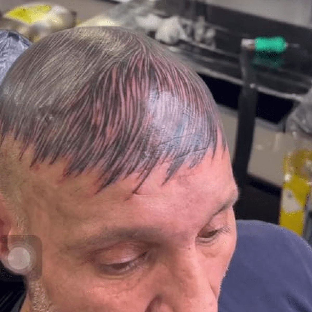 This Is Not a Hair Transplant, It's a Tattoo - Bellatory News