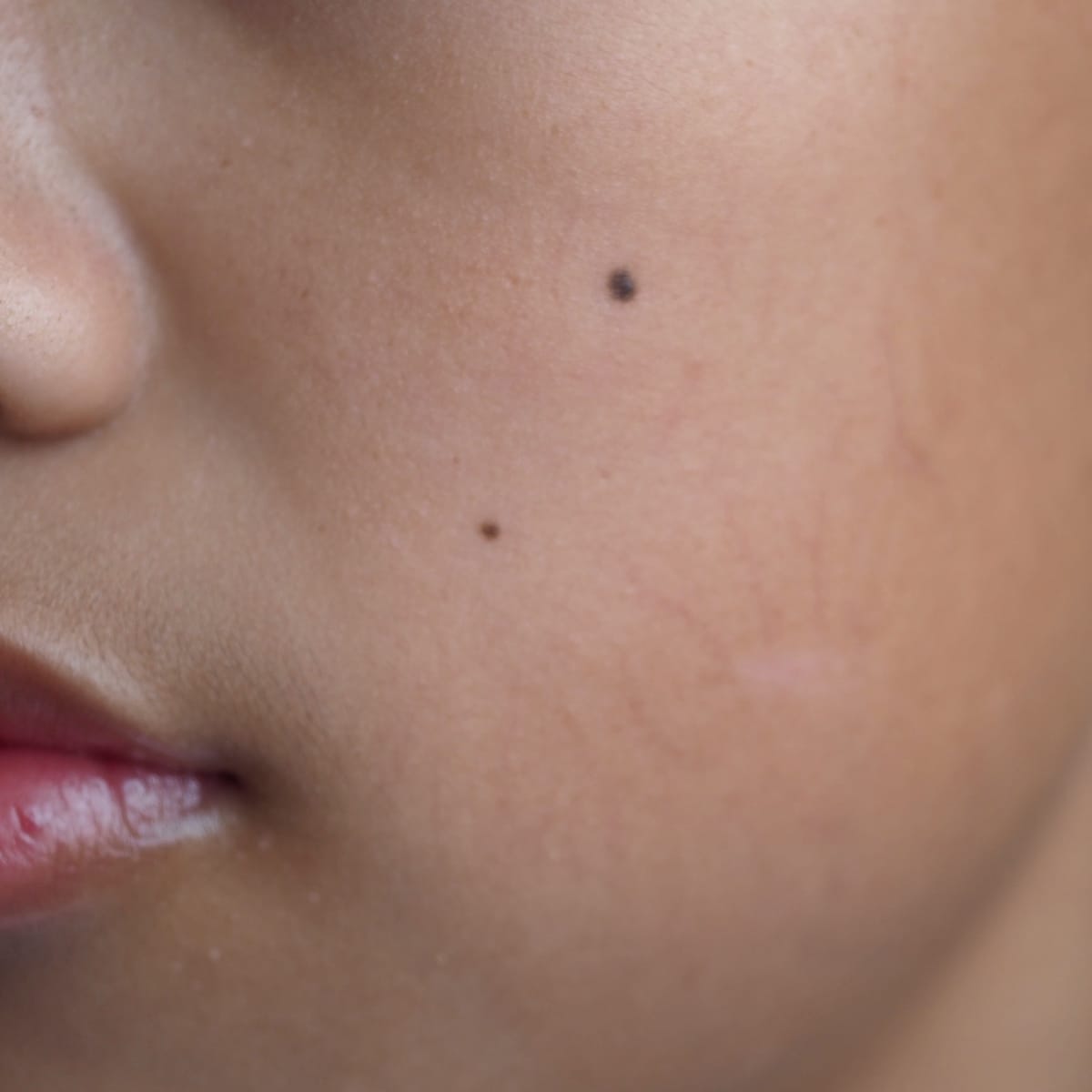 Watch This Woman Turn A Pimple Into A Beauty Mole Instantly
