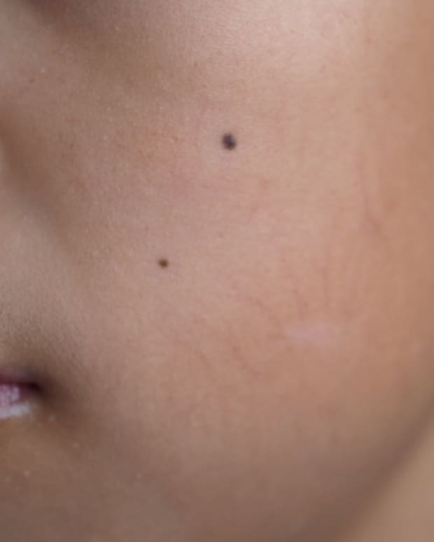 Brown woman with beauty moles on her face